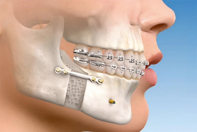 Servicos03 Cirurgia ortognática em são paulo