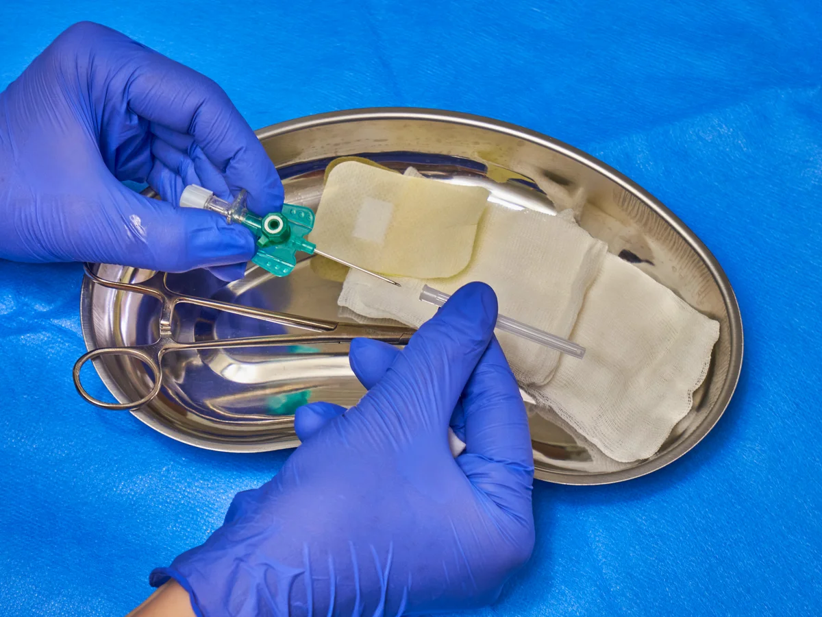 Implantes faciais definitivos - próteses faciais - harmonização facial definitiva